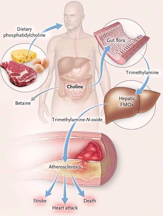 Managing Cholesterol and Fatty Liver